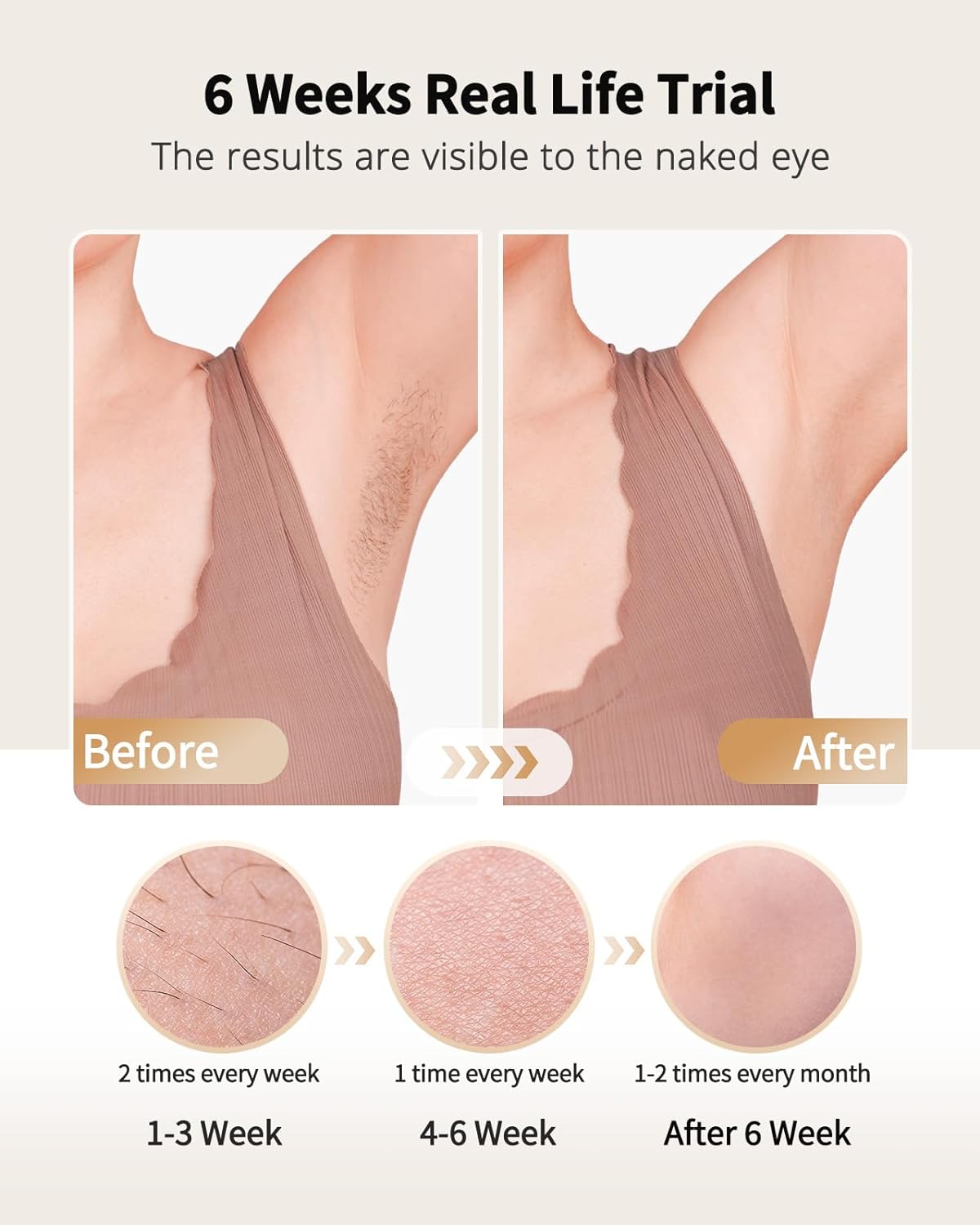Laser Hair Removal with Ice Co - Hair Care Or Haircare recension och pris