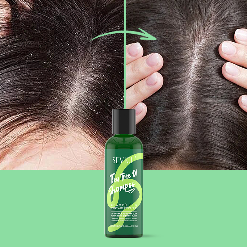Tea Tree Essence Shampoo Hair  - Hair Care Essence recension och pris
