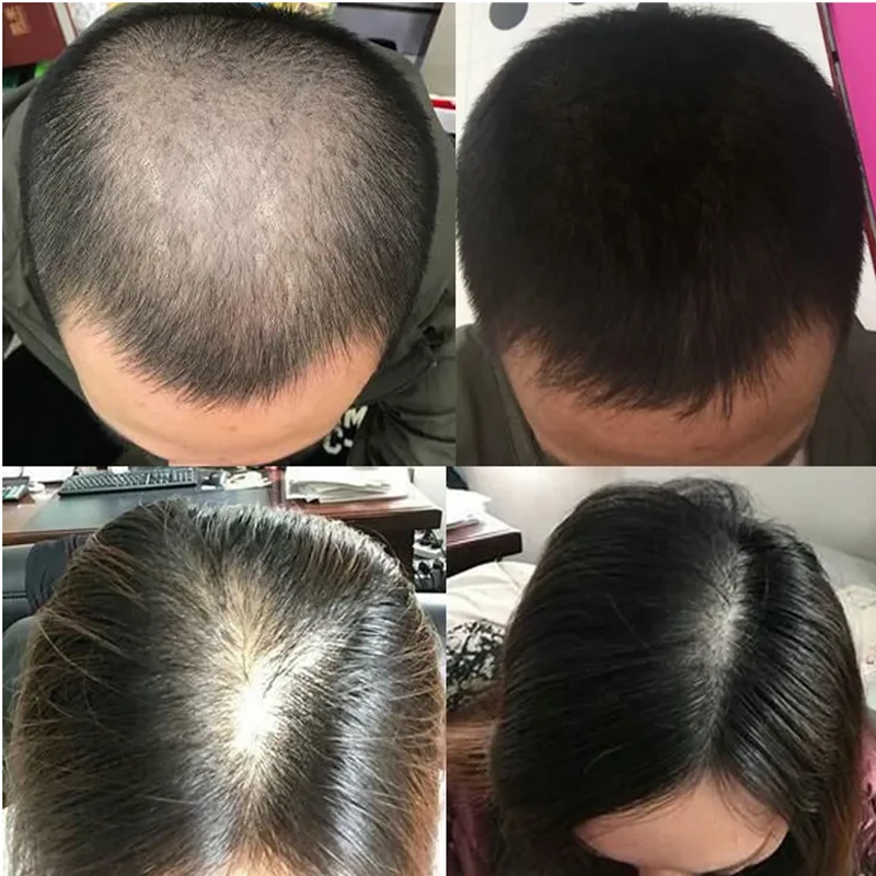 Overlord Plant Hair Growth Liq - Hair Care Or Haircare recension och pris