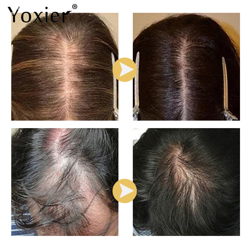 Intensive Growth Serum Prevent - Hair Care Serum recension och pris