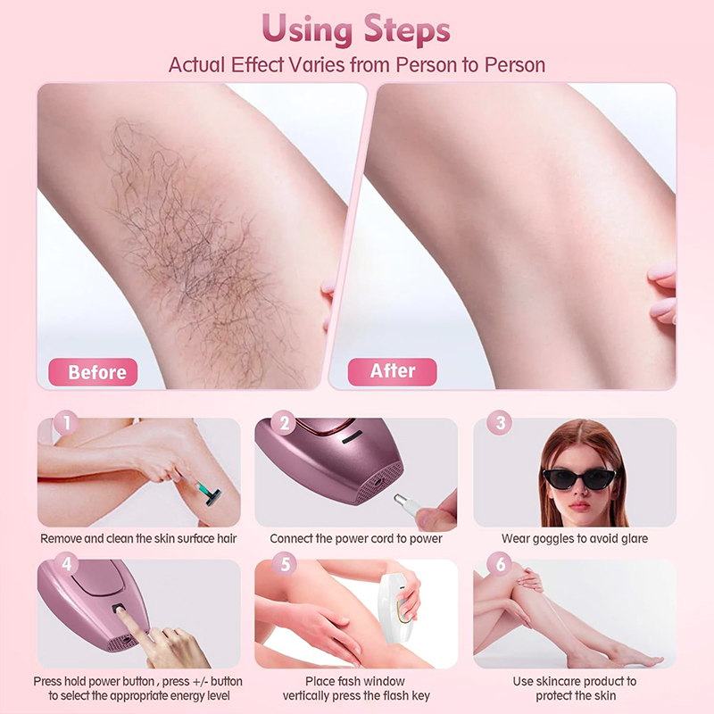 IPL laser Hair Remover Hair Cu - Hair Care Or Haircare recension och pris