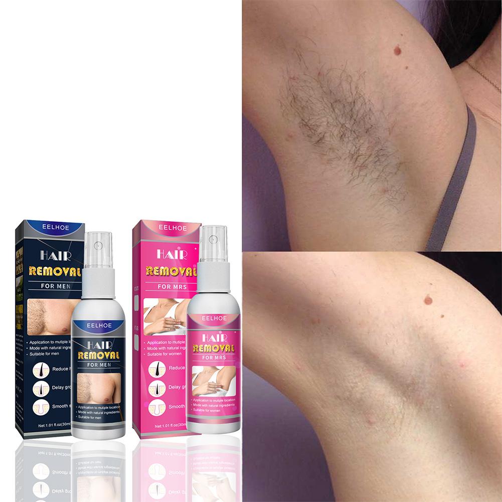 1/2PCS Super Natural Painless  - Hair Care Spray recension och pris
